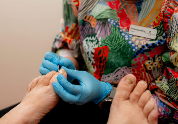 podiatrist helping patients foot with Onyfix nail bracing