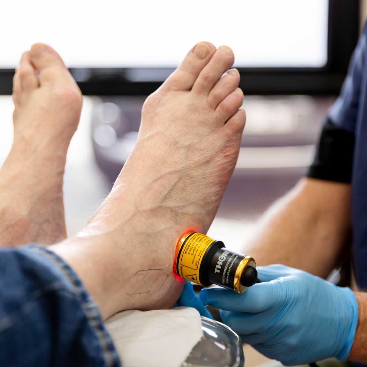 Laser treatment (PBM low level laser therapy) by Total Care Podiatry in Geelong