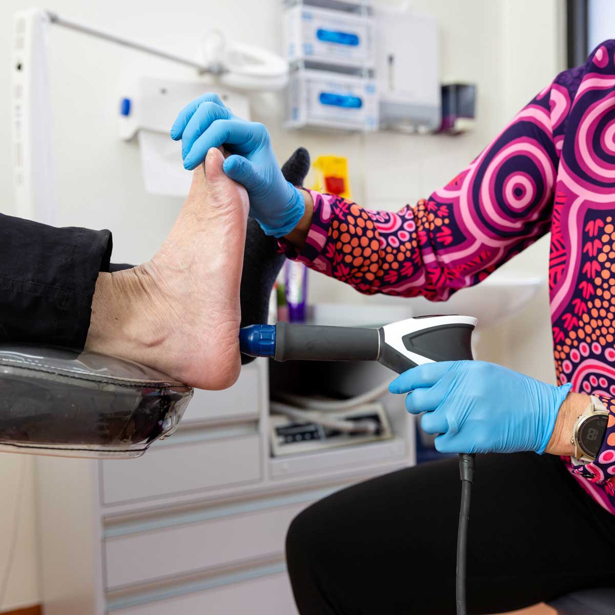 Shockwave therapy for plantar fasciitis treatment in Geelong